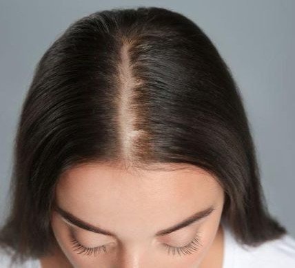 Before Hair